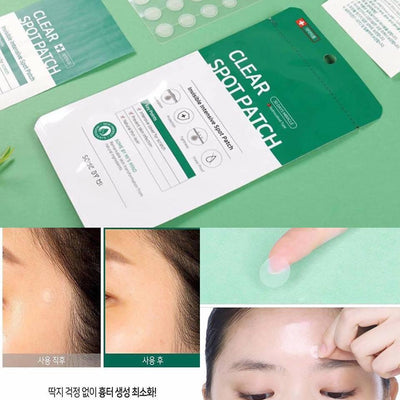 [SOME BY MI] Adesivo Secativo para Acne 30 Days Miracle Clear Spot Patch 18un. 🇰🇷
