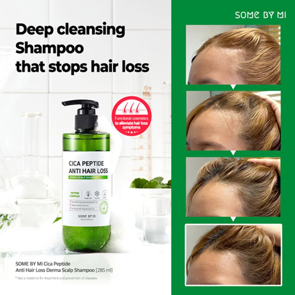 [SOME BY MI] Shampoo Anti Queda Cica Peptide Anti Hair Loss Derma Scalp Shampoo 285ml 🇰🇷