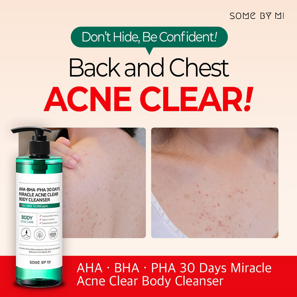 [SOME BY MI] Sabonete Líquido Corporal para Acne AHA BHA PHA 30 Days Miracle Clear Body Cleanser 400g 🇰🇷