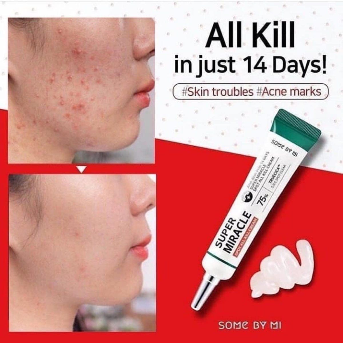 [SOME BY MI] Creme Tratamento para Manchas de Acne AHA BHA PHA 14 DAYS Super Miracle Spot All Kill Cream 30ml 🇰🇷